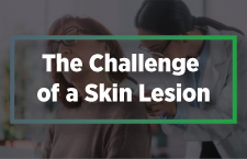 The Challenge of a skin lesion preview