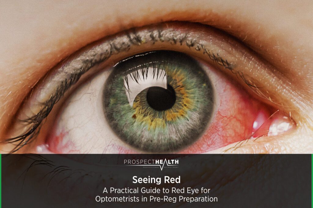 Seeing Red: A Practical Guide to Red Eye for Optometrists in Pre-Reg Preparation