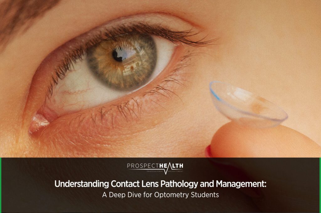 Understanding Contact Lens Pathology and Management: A Deep Dive for Optometry Students